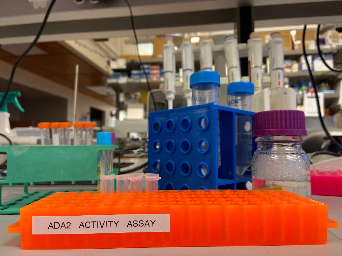 Lab bench with orange microfuge tube block labeled ADA2 Activity Assay.